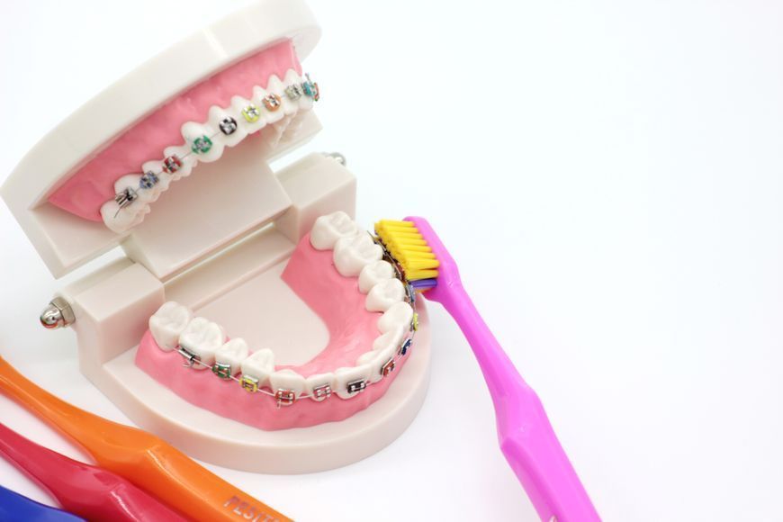 Ортодонтическая зубная щетка 6580 Ortho (красный) 6580Ortho-4 фото